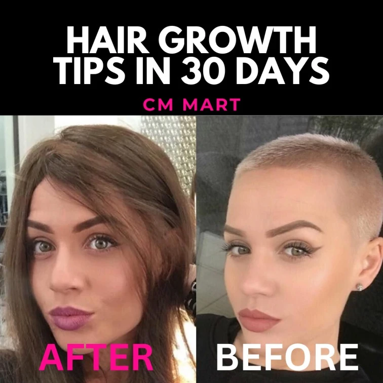 Onion Hair Oil-Extreme Hair Growth In 30 Days